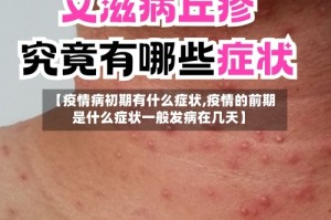 【疫情病初期有什么症状,疫情的前期是什么症状一般发病在几天】