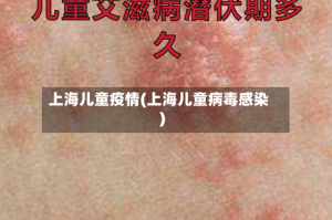 上海儿童疫情(上海儿童病毒感染)