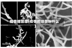 疫情细菌图(疫情的细菌叫什么)