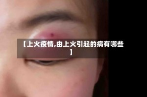 【上火疫情,由上火引起的病有哪些】