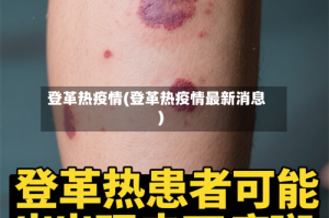登革热疫情(登革热疫情最新消息)
