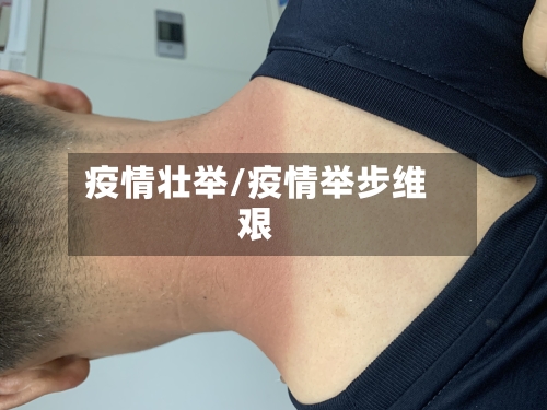 疫情壮举/疫情举步维艰-第1张图片
