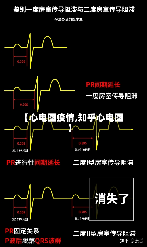【心电图疫情,知乎心电图】-第1张图片