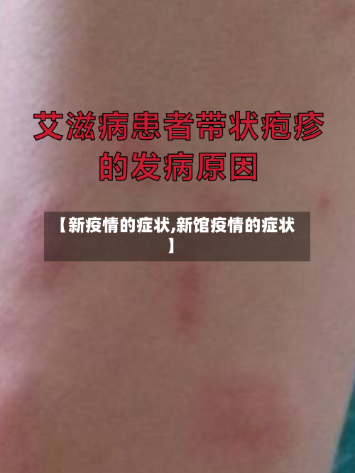 【新疫情的症状,新馆疫情的症状】-第1张图片