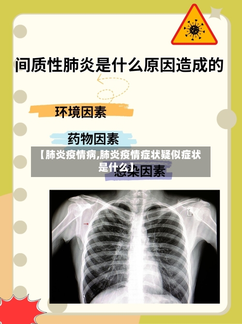 【肺炎疫情病,肺炎疫情症状疑似症状是什么】-第2张图片