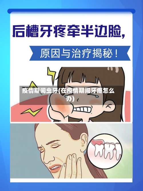 疫情期间虫牙(在疫情期间牙疼怎么办)-第1张图片