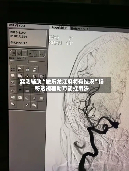 实测辅助“微乐龙江麻将有挂没”揭秘透视辅助万能挂用法-第2张图片